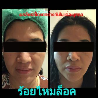 Before / After