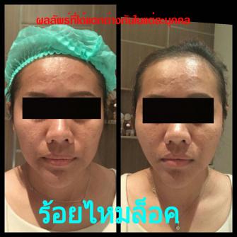 Before / After