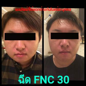 Before / After