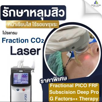 ใหม่ !! โปรคอมโบเลเซอร์ผีลืมหลุม