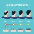 ปลูกผมและคิ้วด้วย FUE ( Follicular Unit Extraction )  Hair Transplantation by FUE