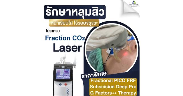 ใหม่ !! โปรคอมโบเลเซอร์ผีลืมหลุม